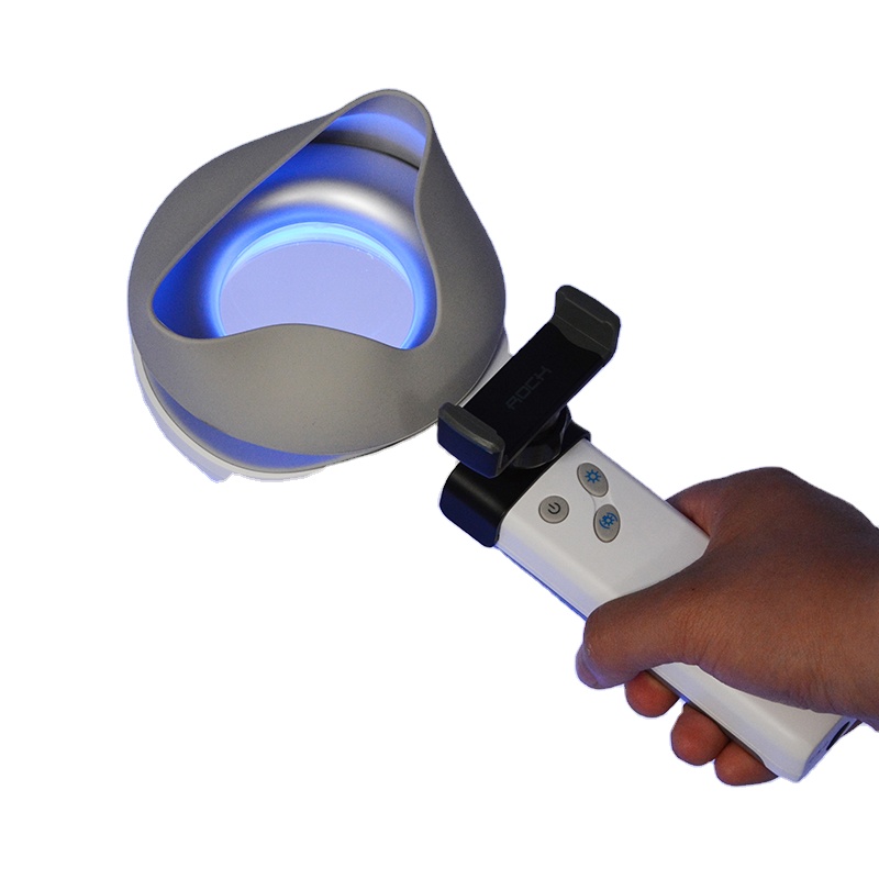 Skin Disorder  Depigmentation  - đánh giá và giá Led Medical Headlight