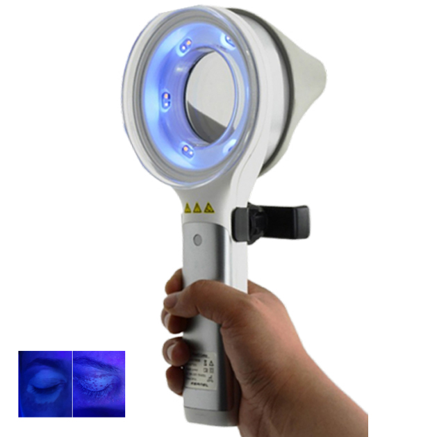 Skin Disorder  Depigmentation  - đánh giá và giá Led Medical Headlight